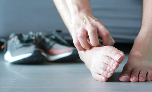 Combating Athlete's Foot: The Best Socks for Prevention and Treatment